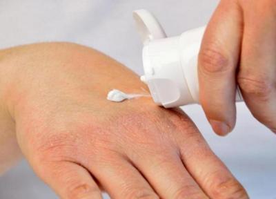 ویروس کرونا؛ چگونه پوست دست را از خشک شدن نجات دهیم؟